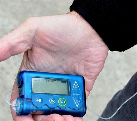 rfid chip diabetes|FDA approves first continuous glucose monitoring system with a .